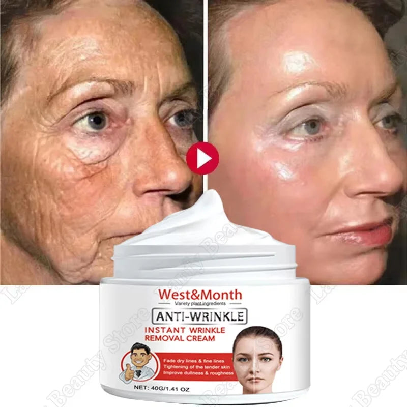 Crema de Retinol Anti-Edad Fantasy – Reafirmante, Lifting y Antiarrugas